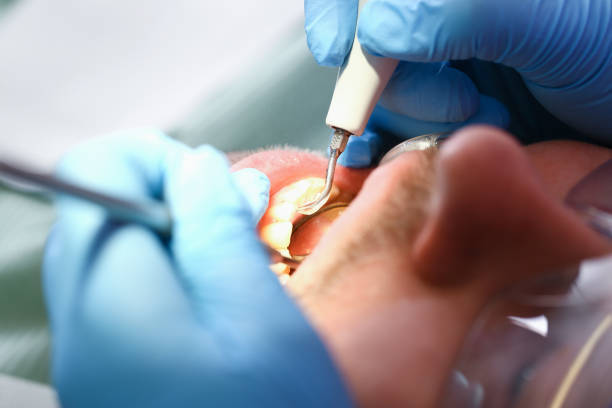 Best Knocked-Out Tooth Emergency  in Hart, TX